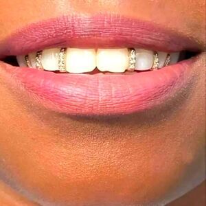 5pc Silver Diamond Grille Set